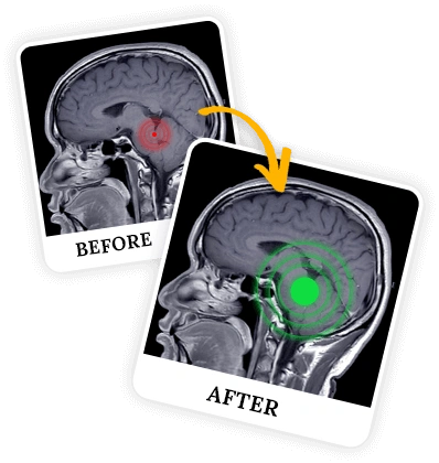 What is  Billionaire Brain Wave?